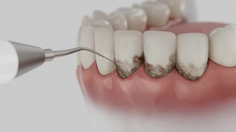 Reliable Emergency Dentist contractor in Davie, FL by Smile Center Dentistry